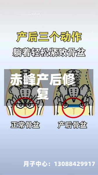 赤峰产后修复