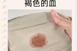 备孕总是排卵期出血咋回事