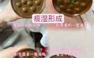 剖腹产痒擦什么
