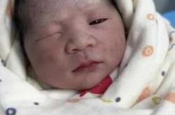 婴儿眼睛图片什么样