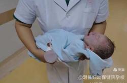 剖腹产宝宝头会圆吗