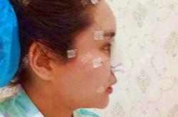 硅胶婴儿有哪些潜在风险呢