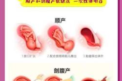 剖腹产和顺产究竟哪个好