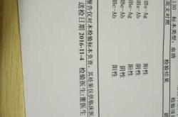 备孕做抗原检测影响吗