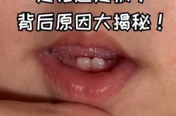 新生儿出牙是怎么回事