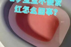 新生儿爱尿怎么回事