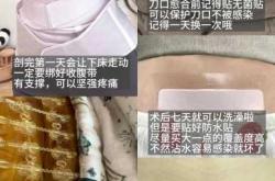 剖腹产为何不能缝合