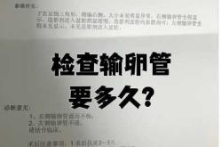 昨晚造影后什么时候能备孕