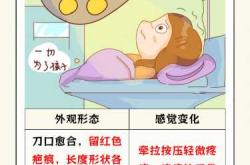 剖腹产牵拉伤口怎么办