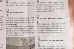 剖宫产后多久可以同房