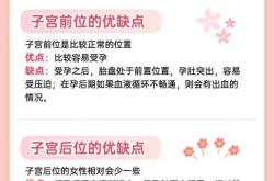 子宫后位易顺产吗