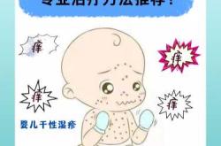 婴儿常见皮肤问题怎么办