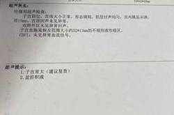 怀孕5周能不能查出来