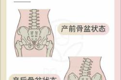 产后崩漏有哪些具体症状