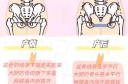 产后盆底检查怎么做