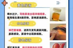 尿不湿腰处红怎么回事