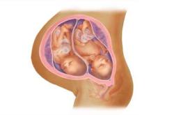 备孕女梦见双胞胎预示什么