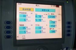 新生儿正压通气频率是多少