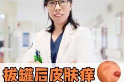 流产后能拔罐吗