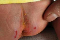 怡儿爽尿不湿好不好用