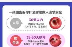 备孕四大误区包括哪些