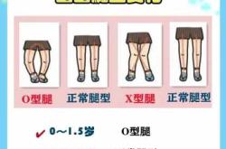 新生儿正常腿型什么样