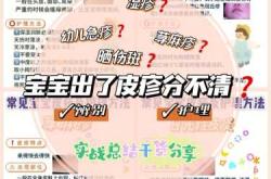 婴儿急性荨麻疹怎么办