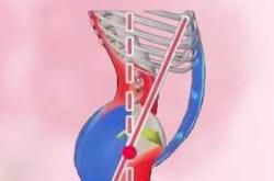 产后盆骨恢复运动有哪些图示