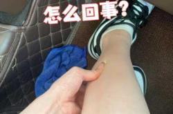 月子里腿酸是怎么回事