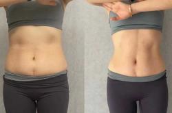 产后肚子大怎么办