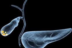 坐月子为何易患结石