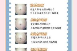 怀孕没长纹产后还会长吗