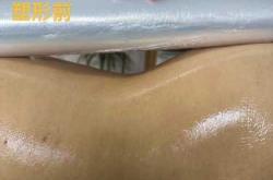 产后塑形加盟前景如何