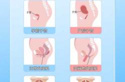 产后子宫积液如何排出