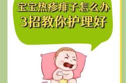 婴儿热痘怎么办