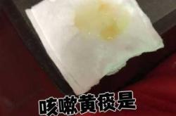 新生儿有痰是不是得了肺炎