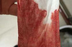 产后一月还有恶露正常吗