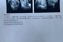 孕期毫无孕反正常吗