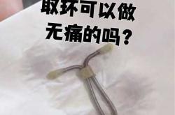 停经后能否取环备孕