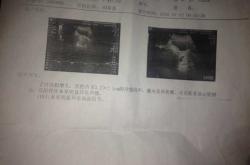 产后五十天又见红咋回事