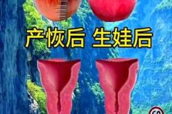 竖刨后能顺产吗