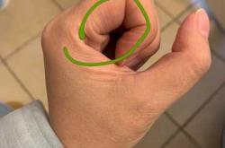 产后双手麻木是怎么回事