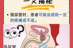 剖腹产插尿管视频教程在哪找