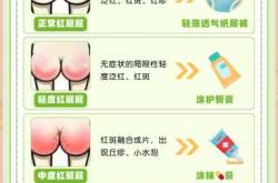 新生儿红屁股怎么有效护理