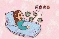 备孕不打疫苗会怎么样