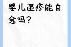 婴儿出湿疹是啥原因