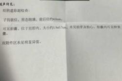 喝酒后怀孕会有影响吗