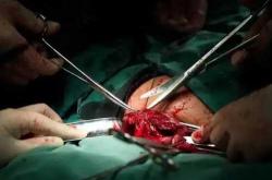 剖腹产人妻需注意什么