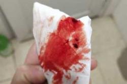 备孕梦到来姨妈见血是怎么回事