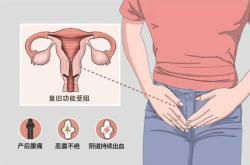 产后子宫图是怎样的